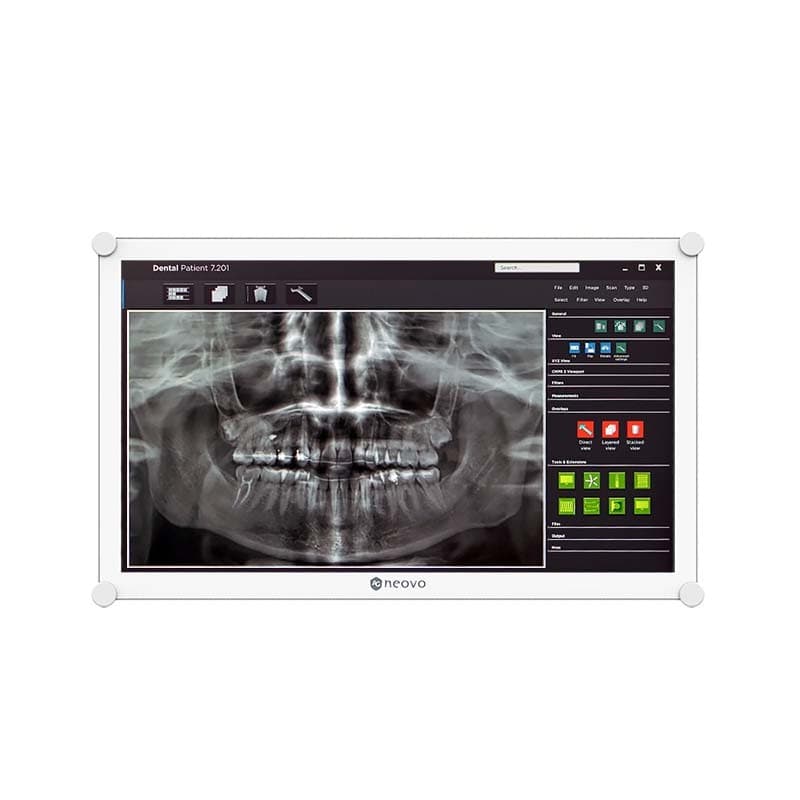 AG Neovo DR-2202 monitor features a sleek black frame, 21.5-inch display with 1920 x 1080 resolution, and is designed for professional use, showcasing a dental X-ray image.