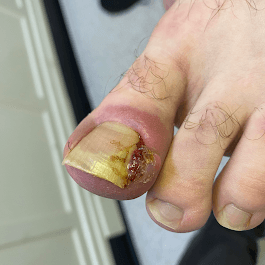 Podocare Podiatry and Chiropody Service - Doctors in bolsterstone ewden village