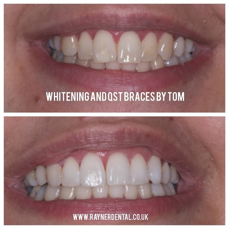 Rayner Dental Practice Wibsey - Dentists in bradford