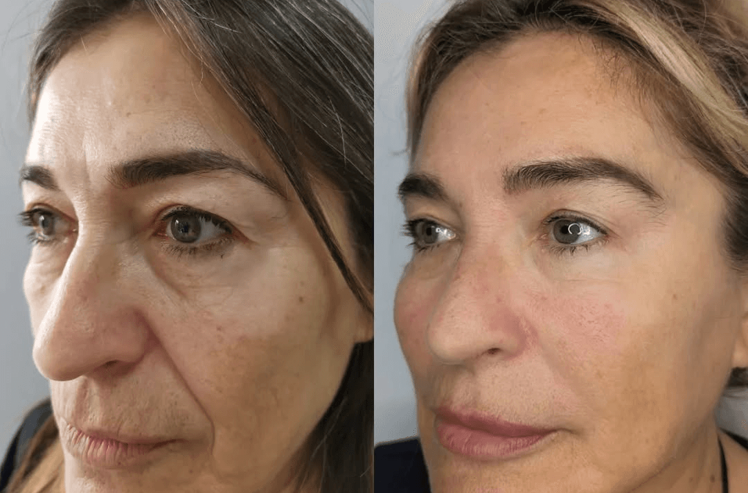 Pure Skin Clinic - Beauty Salons in harrogate