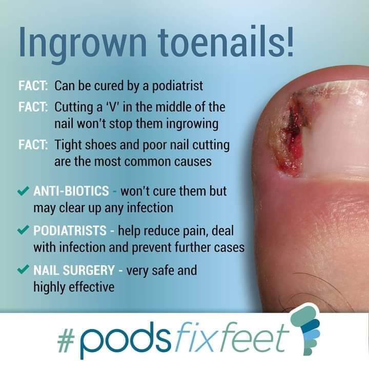 Podiatry and Gait Clinic - Helmsley - Physiotherapists in helmsley