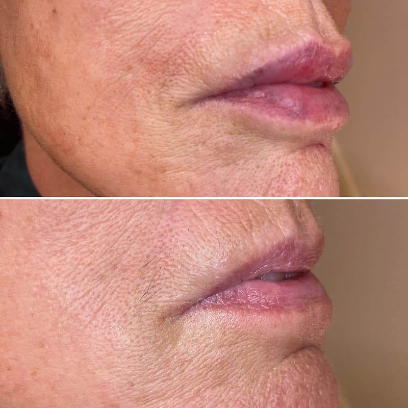 Lopez home injectables - Spa in hessle