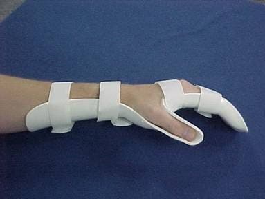 RD - Physio musculoskeletal physiotherapy - Physiotherapists in hull