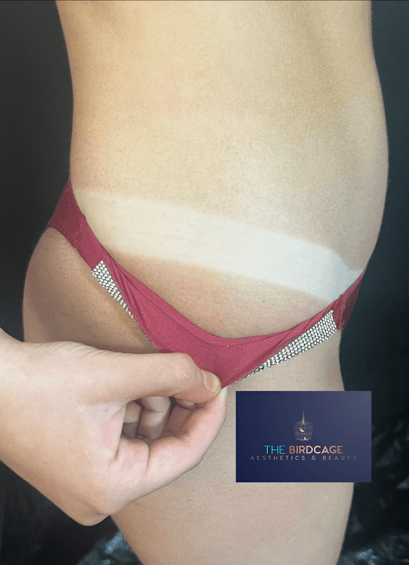 The Birdcage - Aesthetics & Beauty - Beauty Salons in middlesbrough