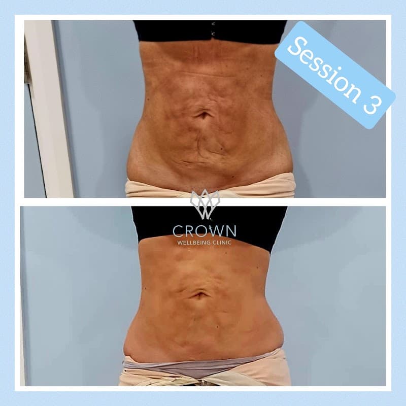 Crown Wellbeing Clinic - Spa in pontefract